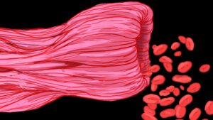 CEL-1